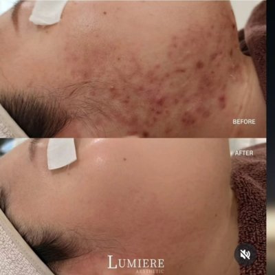 [산본] 반하다피부샵