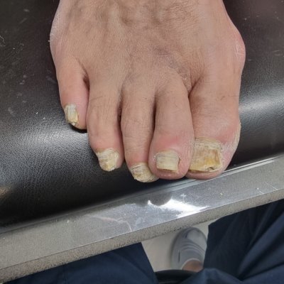 [기자단] 평택라이프365의원