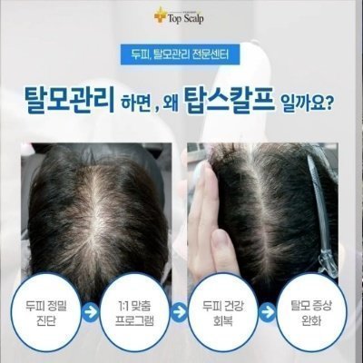 [원주] 탑스칼프 원주점