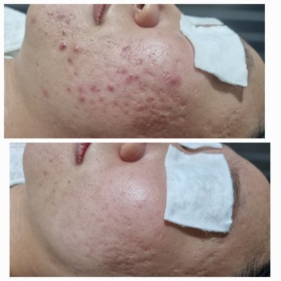 새로고침 스킨케어