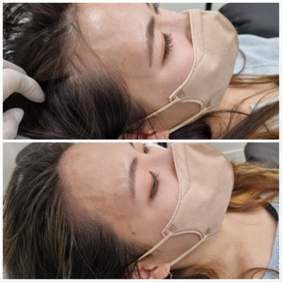 [대구] 새로나다모발킹 칠곡점