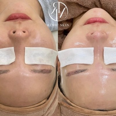 리미크스킨 유성봉명본점