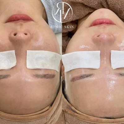 [대전] 리미크스킨 유성봉명본점