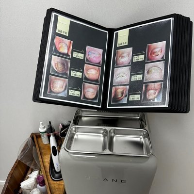 [남양주] 올바른 손발톱클리닉