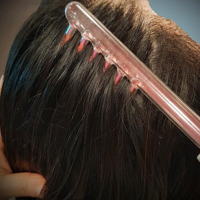 [세종] 이안두피탈모