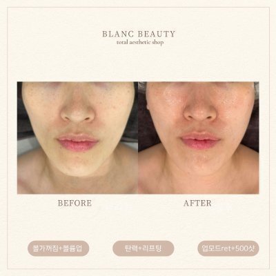 [김해] 블랑뷰티